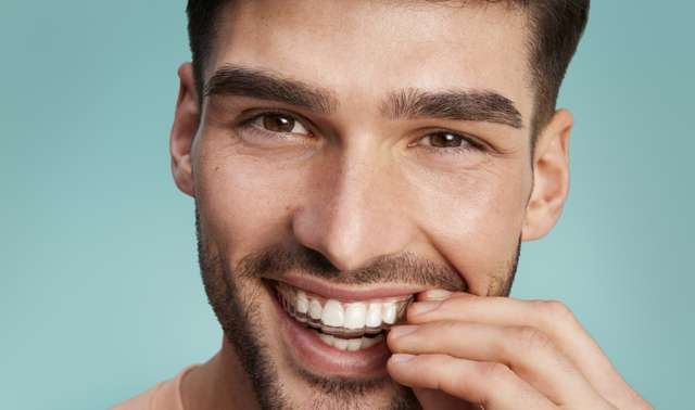 DR SMILE  Allineatori trasparenti per denti più dritti!