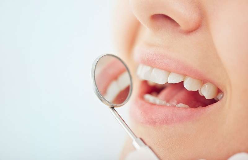Sorriso bocca semi aperta con specchietto dentale