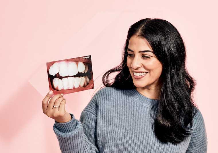 Denti storti prima e dopo