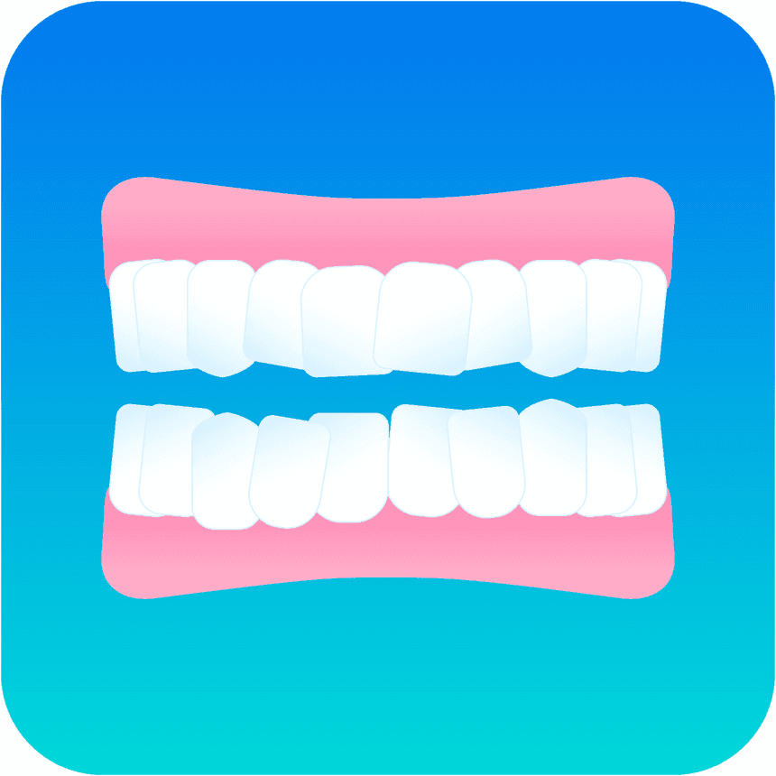 Illustrazione affollamento dentale DR SMILE